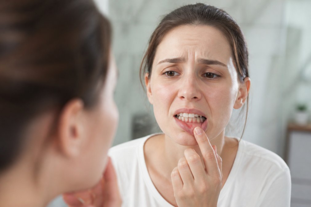 Signs Of Gum Disease You Should Not Ignore
