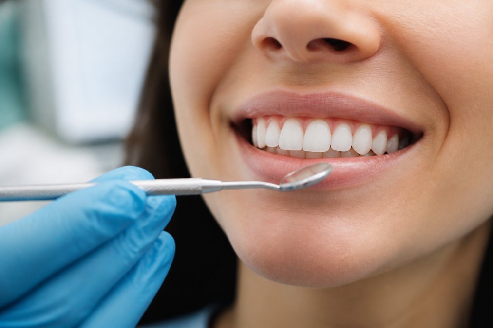 Close-up of a patient's smile showing porcelain veneers with natural translucency and subtle light reflection, seamlessly blending with adjacent natural teeth in a well-lit clinical setting